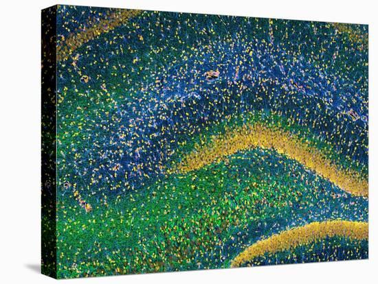 Hippocampus Brain Tissue-Thomas Deerinck-Premier Image Canvas