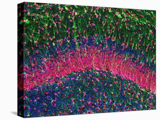 Hippocampus Brain Tissue-Thomas Deerinck-Premier Image Canvas