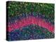 Hippocampus Brain Tissue-Thomas Deerinck-Premier Image Canvas