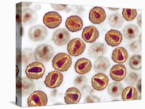 HIV Particles, TEM-Ami Images-Premier Image Canvas