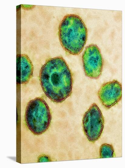 HIV Particles, TEM-Science Photo Library-Premier Image Canvas
