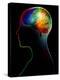 Human Brain, Artwork-Victor Habbick-Premier Image Canvas