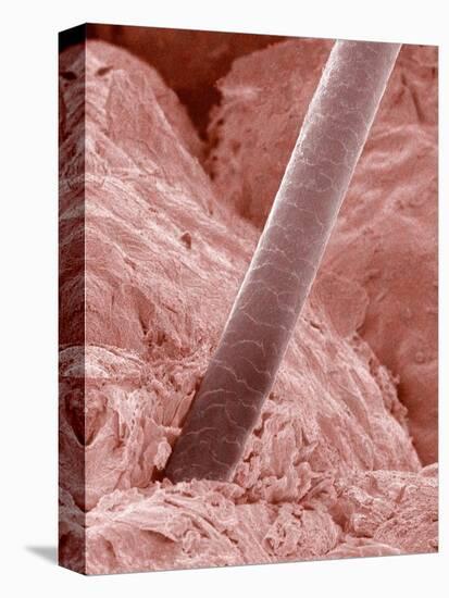 Human Hair and Skin-Micro Discovery-Premier Image Canvas