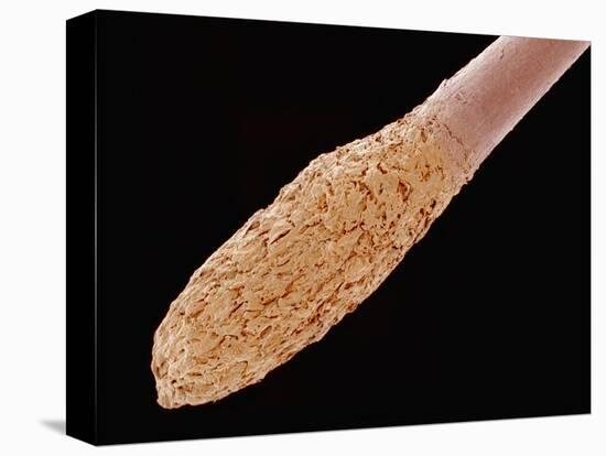 Human Hair Root-Micro Discovery-Premier Image Canvas