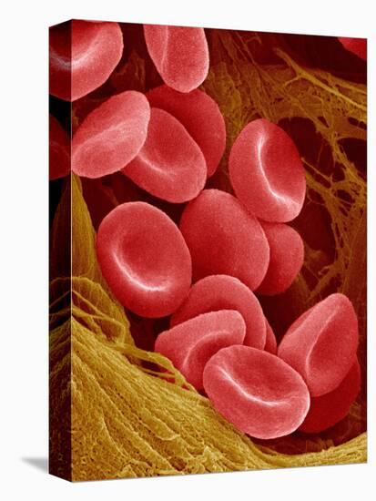 Human Red Blood Cells-Micro Discovery-Premier Image Canvas