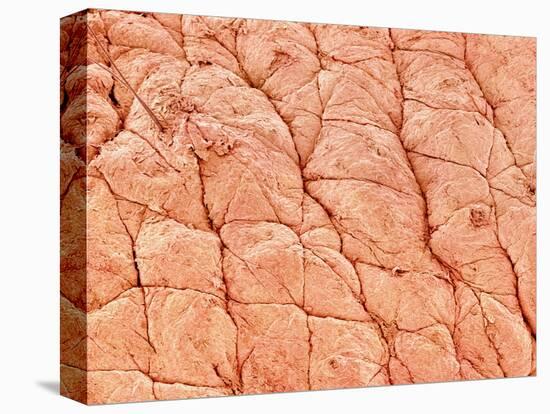 Human Skin-Micro Discovery-Premier Image Canvas