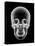 Human Skull, X-ray Artwork-PASIEKA-Premier Image Canvas