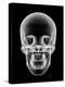 Human Skull, X-ray Artwork-PASIEKA-Premier Image Canvas