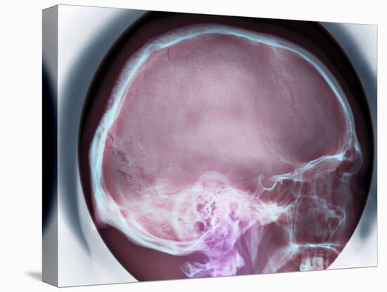 Human Skull, X-ray-Du Cane Medical-Premier Image Canvas