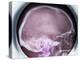 Human Skull, X-ray-Du Cane Medical-Premier Image Canvas