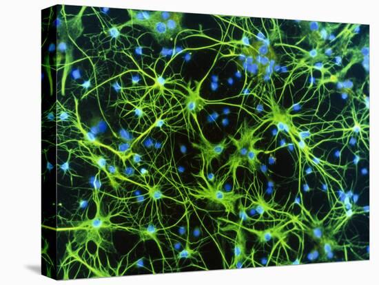 Immunofluorescent LM of Astrocyte Brain Cells-Nancy Kedersha-Premier Image Canvas