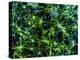 Immunofluorescent LM of Astrocyte Brain Cells-Nancy Kedersha-Premier Image Canvas