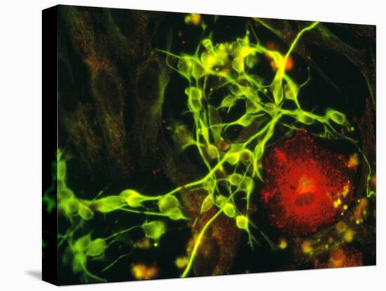 Immunofluorescent LM of Macrophage In Brain Tissue-Nancy Kedersha-Premier Image Canvas