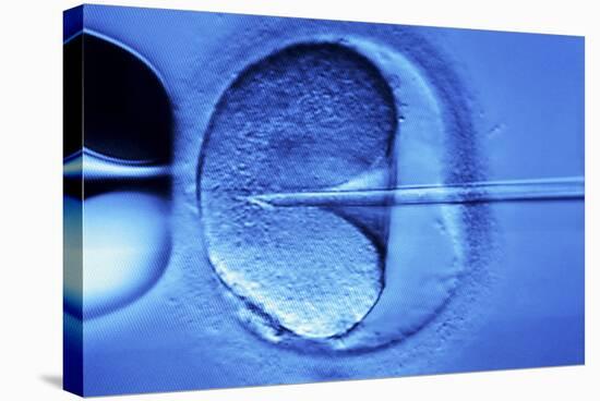 In Vitro Fertilisation-Mauro Fermariello-Premier Image Canvas