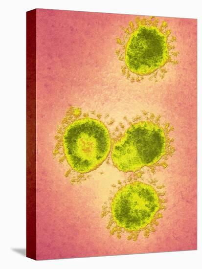 Infectious Bronchitis Virus (IBV), TEM-Ami Images-Premier Image Canvas