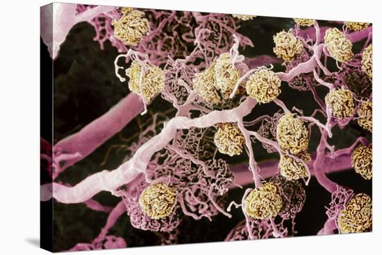 Kidney Glomeruli, SEM-Steve Gschmeissner-Premier Image Canvas