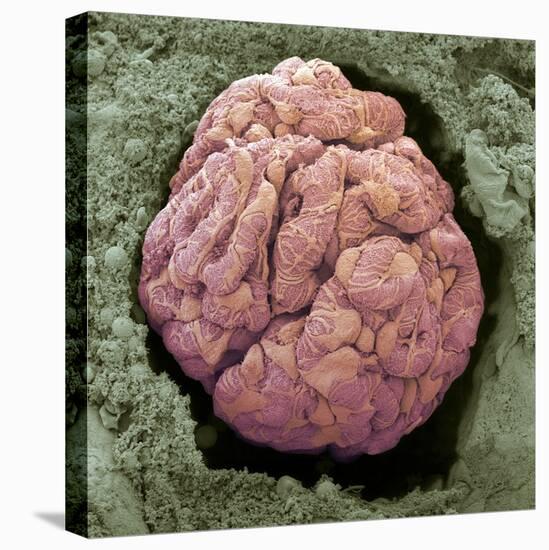 Kidney Glomerulus, SEM-Steve Gschmeissner-Premier Image Canvas