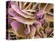 Kidney Stone Crystals, SEM-Steve Gschmeissner-Premier Image Canvas