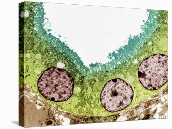 Kidney Tubule, TEM-Steve Gschmeissner-Premier Image Canvas