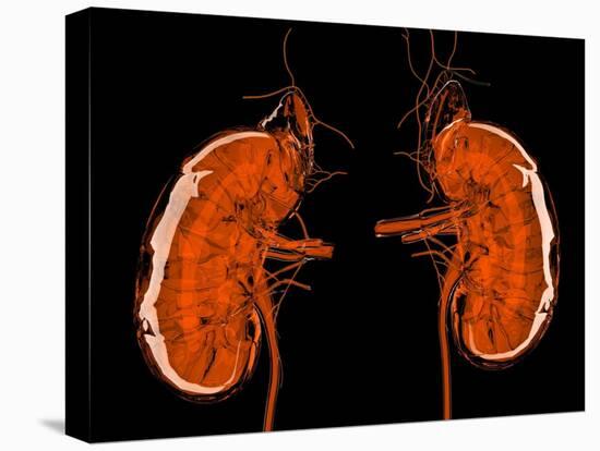 Kidneys, Artwork-Laguna Design-Premier Image Canvas