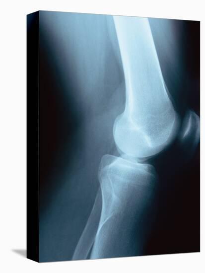 Knee Joint X-Ray-Robert Llewellyn-Premier Image Canvas