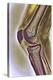 Knee Joint, X-ray-null-Premier Image Canvas