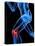 Knee Pain, Conceptual Artwork-SCIEPRO-Premier Image Canvas