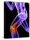 Knee Pain, Conceptual Artwork-SCIEPRO-Premier Image Canvas