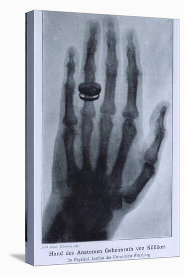 Konrad Roentgen's X-Ray of the Hand of Showing Bones and the Ring, 1895-null-Stretched Canvas