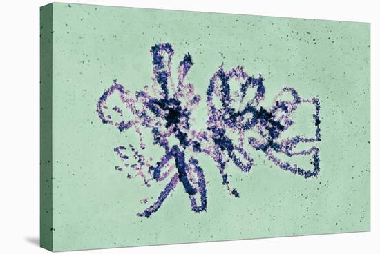 Lampbrush Chromosomes, TEM-Science Photo Library-Premier Image Canvas