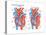 Left Ventricular Hypertrophy-Encyclopaedia Britannica-Stretched Canvas