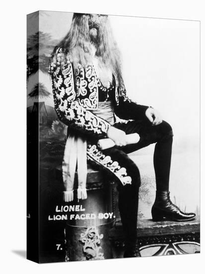Lion-Faced Man, 1907-null-Premier Image Canvas