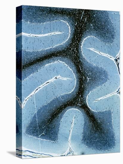 LM of Cortex And Medulla of the Cerebellum-Volker Steger-Premier Image Canvas