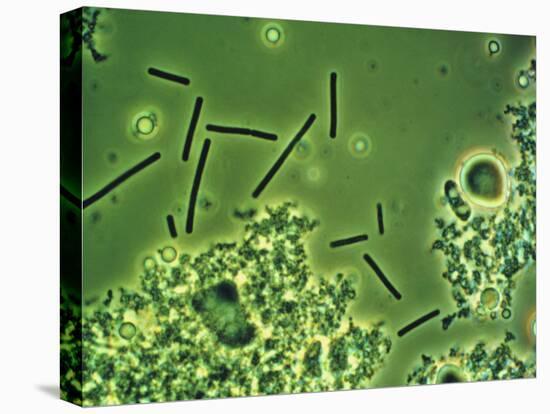 LM of Lactobacillus Bulgaricus Bacteria-John Walsh-Premier Image Canvas