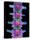 Lumbar Spine, X-ray-Science Photo Library-Premier Image Canvas