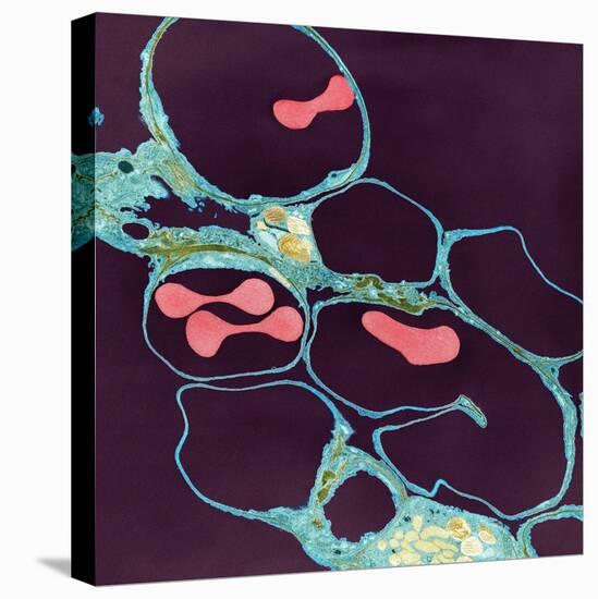 Lung Alveoli And Red Blood Cells, TEM-Thomas Deerinck-Premier Image Canvas