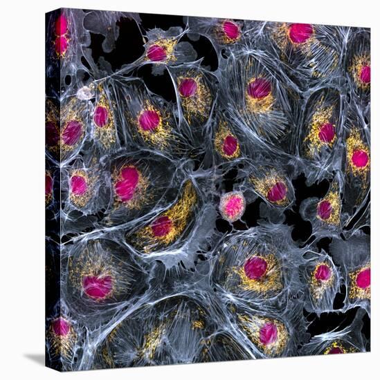 Lung Cells, Fluorescent Micrograph-Dr. Torsten Wittmann-Premier Image Canvas