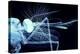 Male Mosquito Head, Light Micrograph-Steve Gschmeissner-Premier Image Canvas