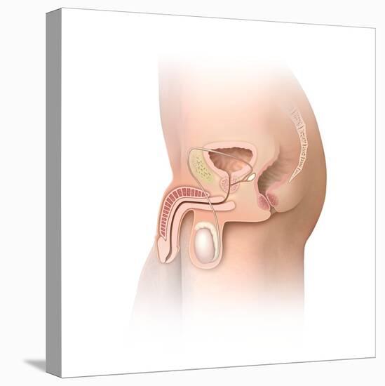 Male Pelvic Region, Artwork-Henning Dalhoff-Premier Image Canvas