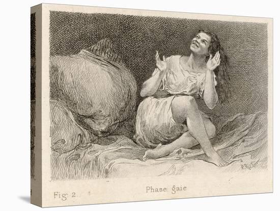 Mental Patient at la Salpetriere Sitting on Her Bed in Phase Gaie-Richer-Premier Image Canvas