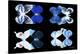 Miss Butterfly X-Ray Duo Black V-Philippe Hugonnard-Stretched Canvas