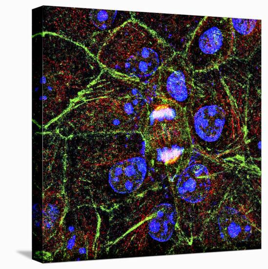 Mitosis, Fluorescence Micrograph-Science Photo Library-Premier Image Canvas