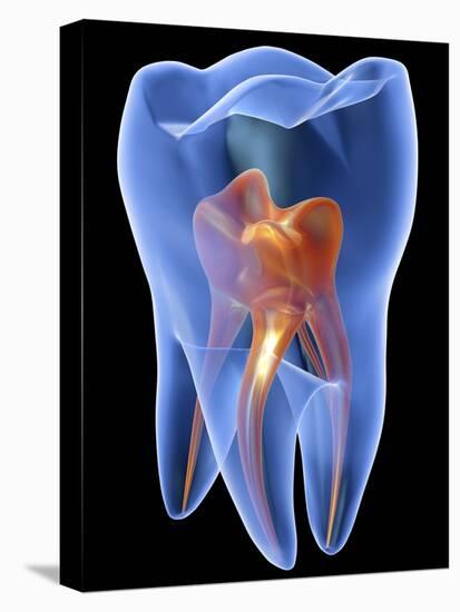 Molar Tooth-PASIEKA-Premier Image Canvas