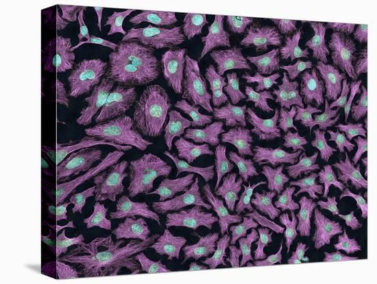 Multiphoton Fluorescence Image of Hela Cells-Stocktrek Images-Premier Image Canvas