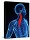 Neck Pain, Conceptual Artwork-SCIEPRO-Premier Image Canvas