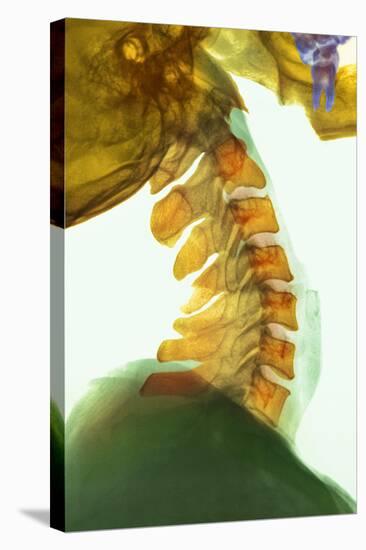 Neck Vertebrae Flexed, X-ray-Science Photo Library-Premier Image Canvas