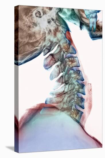 Neck Vertebrae Flexed, X-ray-Science Photo Library-Premier Image Canvas