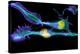 Nerve Cancer Cells, Light Micrograph-Dr. Torsten Wittmann-Premier Image Canvas