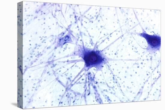 Nerve Cells, Light Micrograph-Steve Gschmeissner-Premier Image Canvas