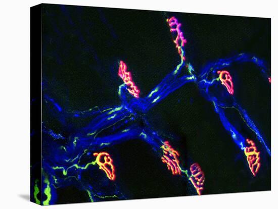 Neuromuscular Synapse, Light Micrograph-Thomas Deerinck-Premier Image Canvas